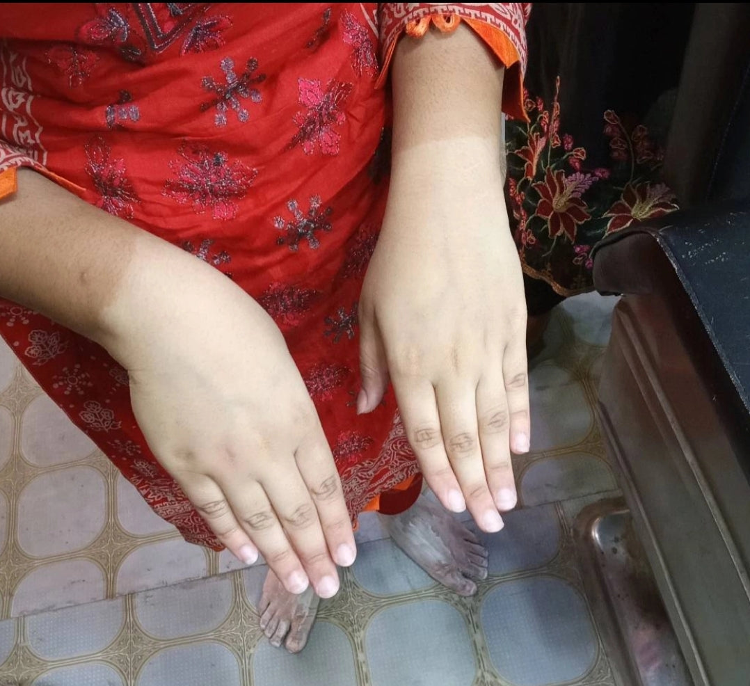 24k Gold Skin Polish + Zafrani Beauty Cream Free 🎁 With 100% Results